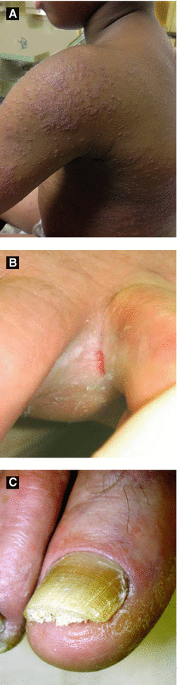 Infectious Diseases Springerlink