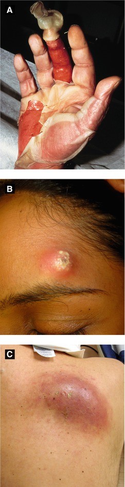 Infectious Diseases Springerlink