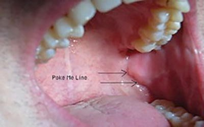 Local and Regional Anesthesia in Dental and Oral Surgery | SpringerLink Local and Regional Anesthesia in Dental and Oral Surgery | SpringerLink