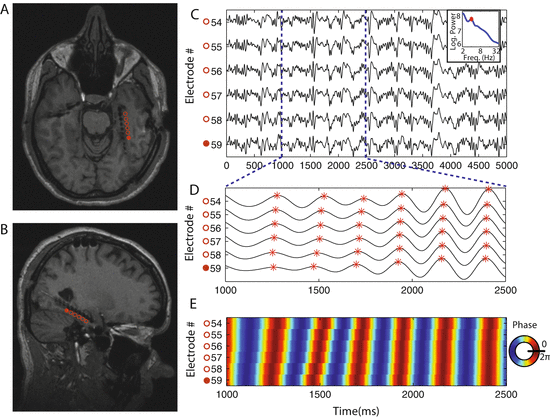 Human Hippocampal Theta Oscillations Distinctive Features And Interspecies Commonalities Springerlink