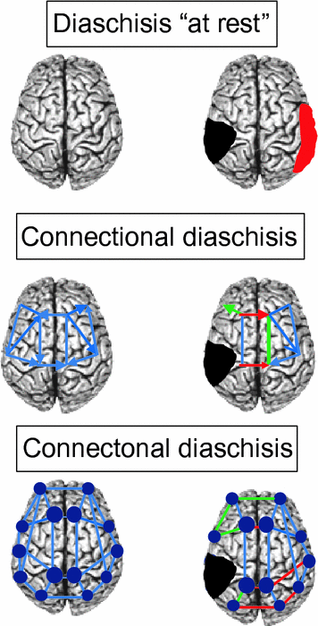 Resilience Of Brain Networks After Stroke Springerlink