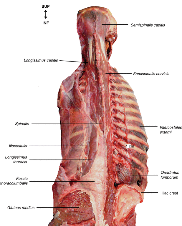 Interspinales