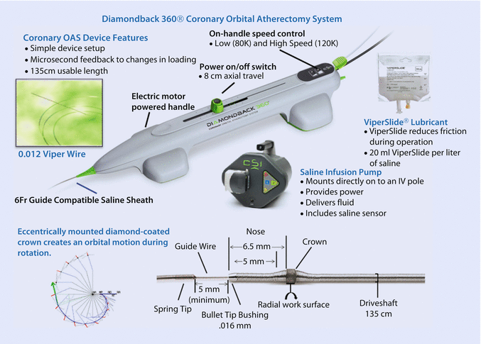Coronary Orbital Atherectomy Springerlink