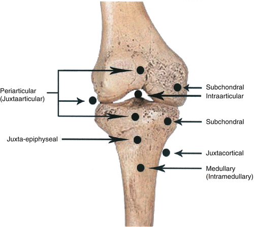 Basic Sciences Of Bone And Joint Diseases Springerlink