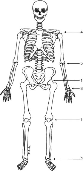 Diagnosis Of Inflammatory Bone Diseases Springerlink