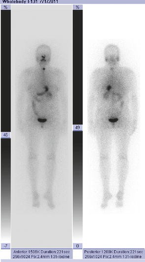 The Thyroid Gland Springerlink
