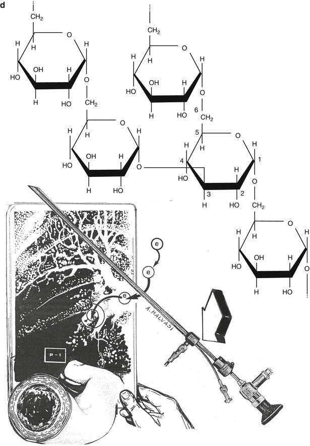 Complications During Hysteroscopy Springerlink