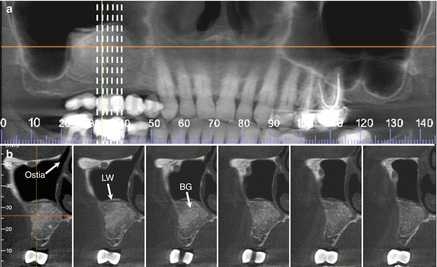 exporting x-rays galileos viewer exporting x-rays galileos viewer