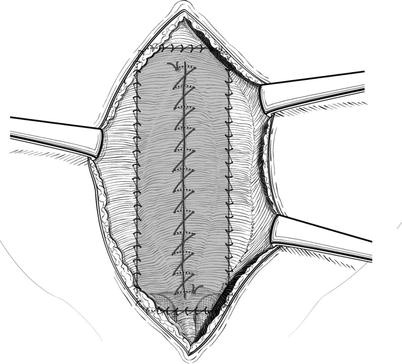 Open Repair Springerlink