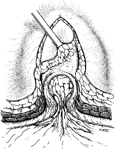 Open Repair Springerlink