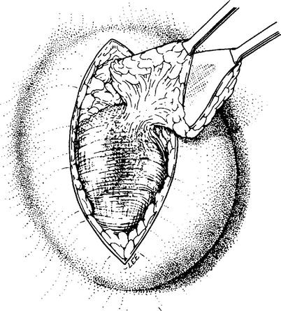 Open Repair Springerlink