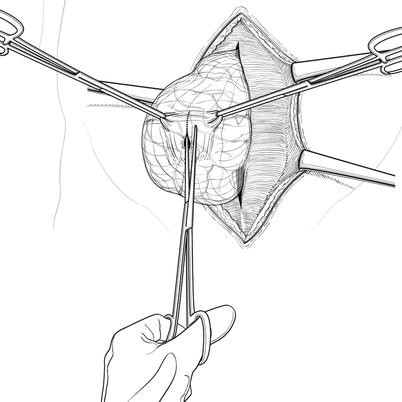 Open Repair Springerlink