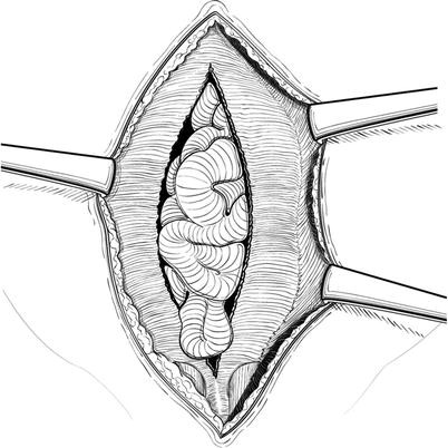 Open Repair Springerlink