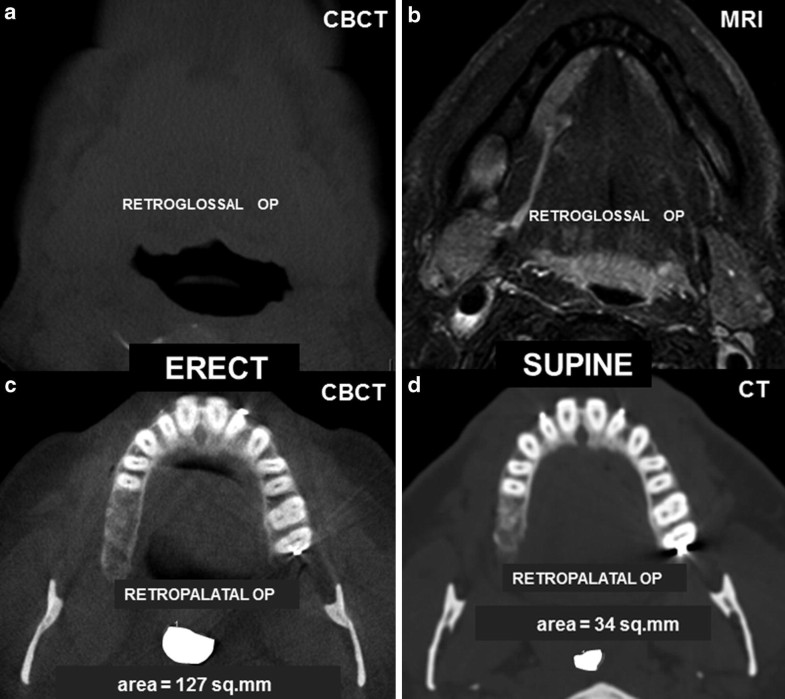 Diagnostic Imaging Principles And Applications In Head And Neck