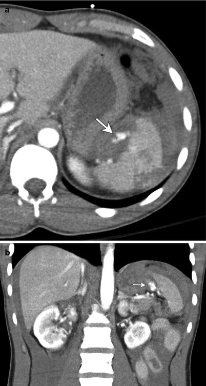 Emergency Radiology Of The Abdomen And Pelvis Imaging Of - 