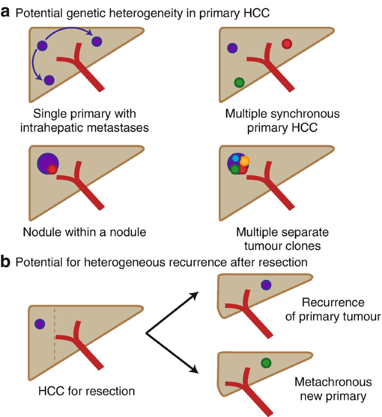 Mechanisms Of Disease The Damaged Genome In Hcc Springerlink