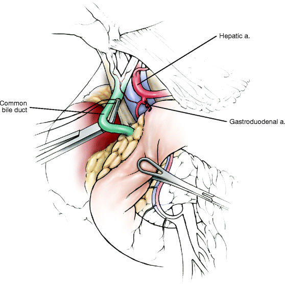Pancreas and Duodenum | SpringerLink