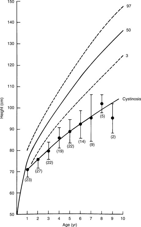 bone age less than chronological age bone age less than chronological age