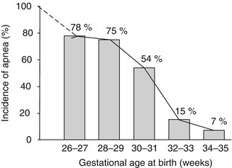 Acute Neonatal Respiratory Failure Springerlink