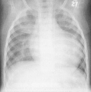 Lysosomal Storage Diseases Springerlink Lysosomal Storage Diseases Springerlink