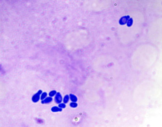 Malassezia Fungemia, Antifungal Susceptibility Testing and Epidemiology ...