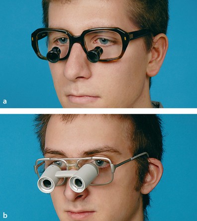 Refraktionsfehler: Brillen, Kontaktlinsen und refraktive Chirurgie |  SpringerLink
