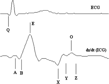 definition of cardiograph definition of cardiograph