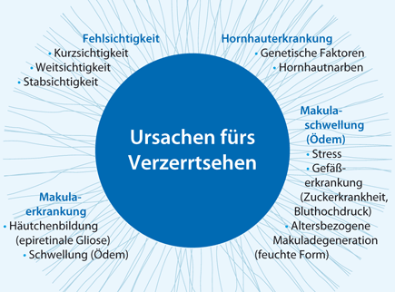 Verzerrtsehen Wenn Gerade Linien Wellig Werden Springerlink