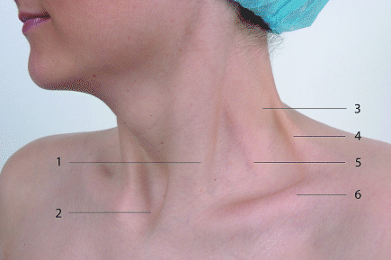 Interskalenäre Blockade SpringerLink