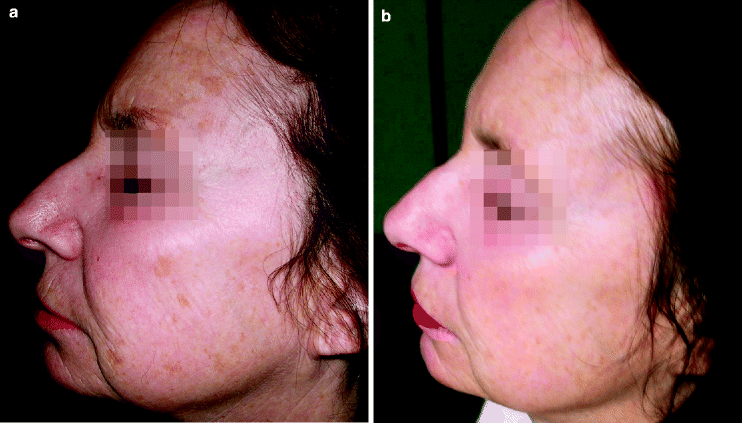 Pyruvic Acid Springerlink - 