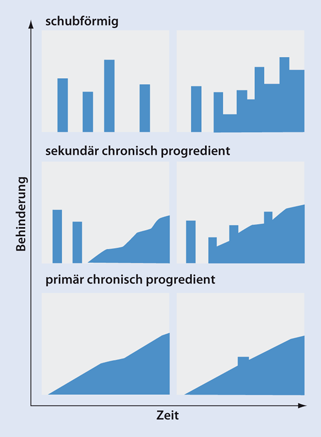 Multiple Sklerose Und Andere Autoimmune Zns Erkrankungen Springerlink