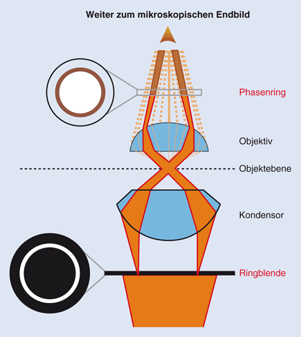 Mikroskopie In Der Gynäkologischen Praxis Springerlink - 