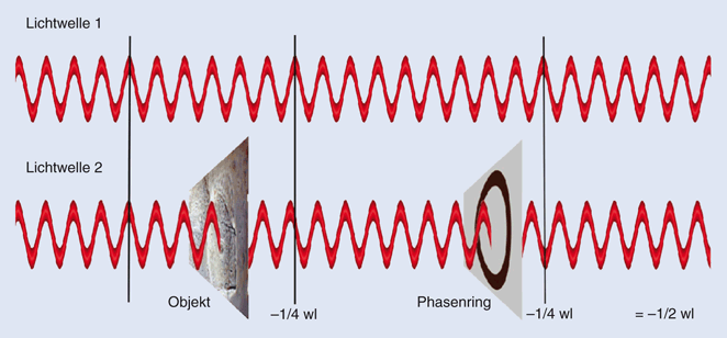 Mikroskopie In Der Gynäkologischen Praxis Springerlink - 