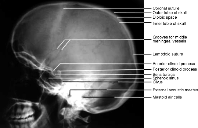 Skull And Jaw Springerlink