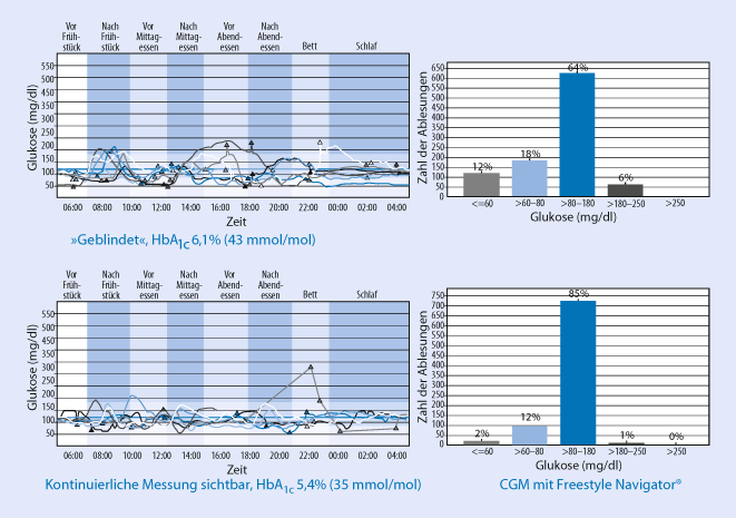 Ernahrung Medikamente Und Stoffwechselkontrollen Springerlink