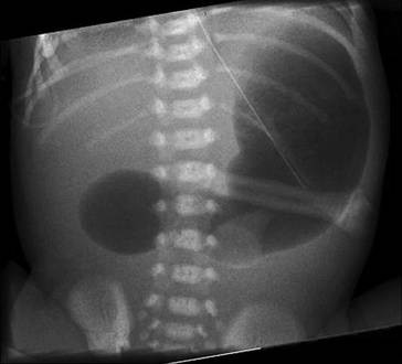 Erkrankungen Und Therapieformen Des Unteren Gastrointestinaltrakts Springerlink