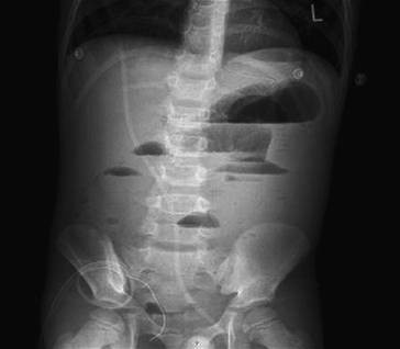 Erkrankungen Und Therapieformen Des Unteren Gastrointestinaltrakts Springerlink
