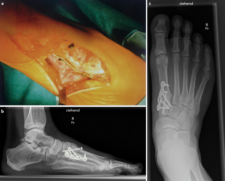 Operative Therapie 1 Strahl Springerlink