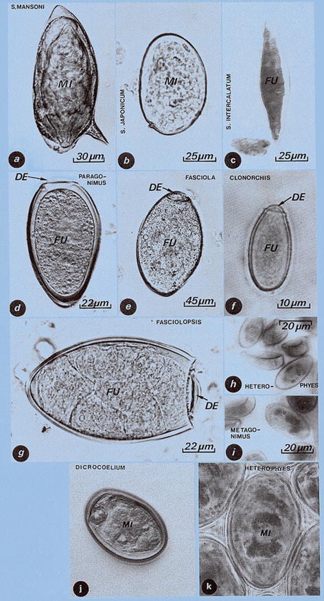 Worm Eggs Of Humans Springerlink