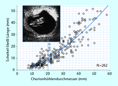 Embryologie Und Fruhschwangerschaft Springerlink