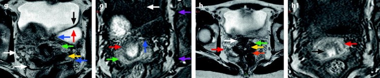 Fig. 2.3