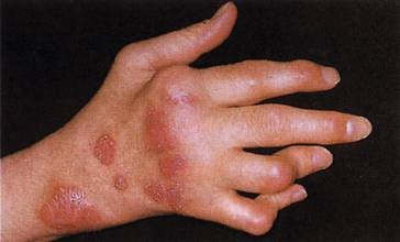 Krankheiten Des Bewegungsapparates Springerlink