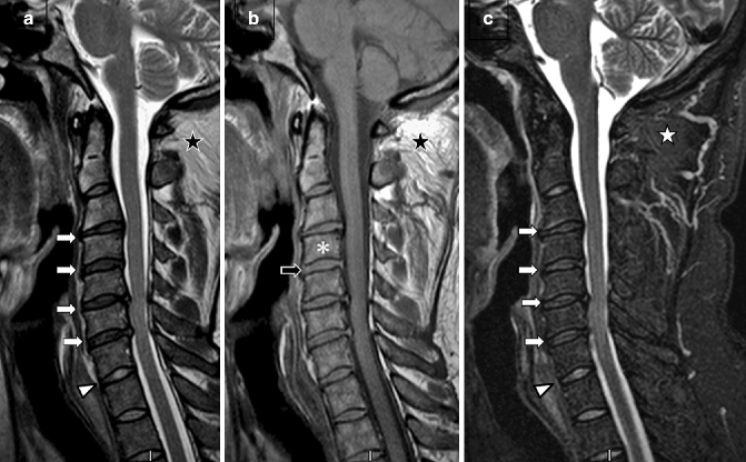 Radiologic Imaging of the Spine | SpringerLink