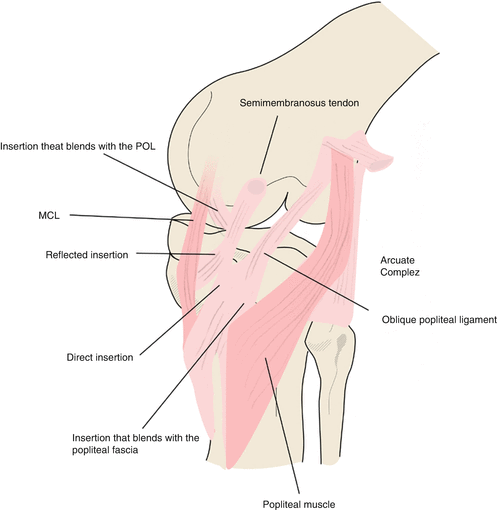 Mcl Medial Collateral Ligament And Pmc Postero Medial Corner Injuries Of The Knee Springerlink