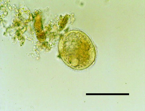 Protozoal Infections Springerlink