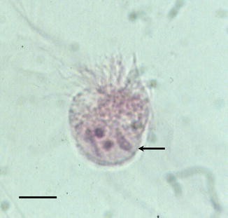 Protozoal Infections Springerlink