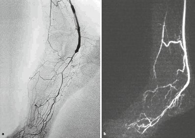 Therapie Springerlink