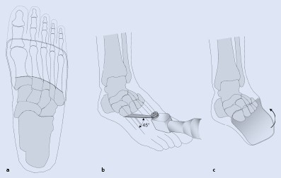 Therapie Springerlink