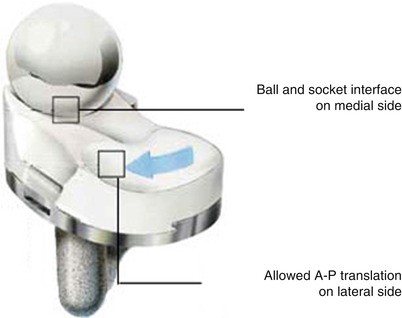 Best Sport Unisexs 10-Piece Aluminium Three-Holes Tensioner Silver Medium
