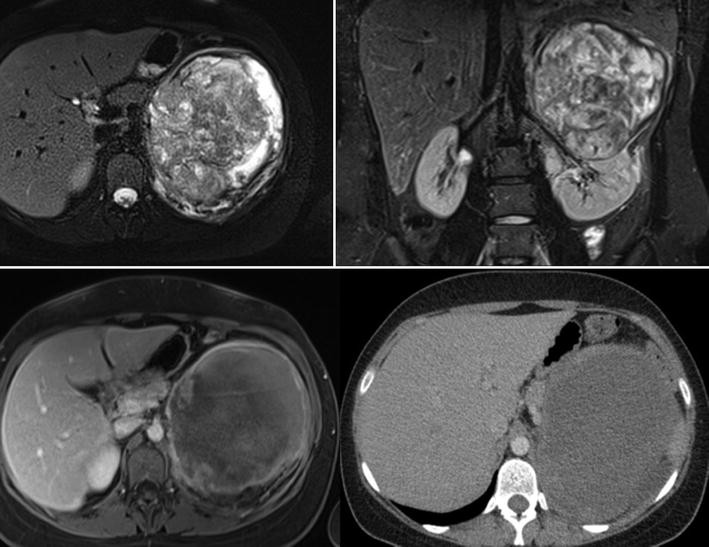 Ct Und Mrt Der Niere Des Retroperitoneums Und Der Harnblase